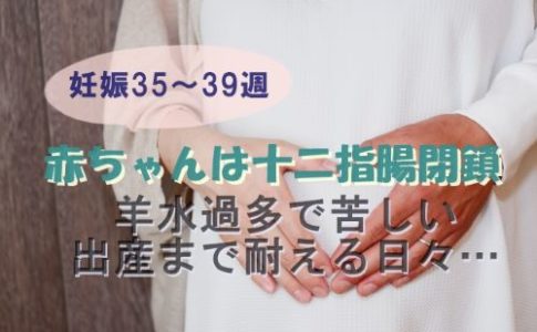 赤ちゃんは十二指腸閉鎖 羊水過多で苦しい 出産まで耐える日々 Mizulog