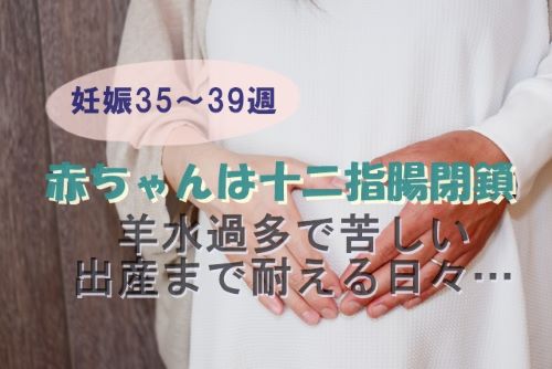 赤ちゃんは十二指腸閉鎖 羊水過多で苦しい 出産まで耐える日々 Mizulog